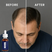 NUVION™ Restore+ Peptide Hair Growth Serum For Men Struggling With Hair Loss & Thinning